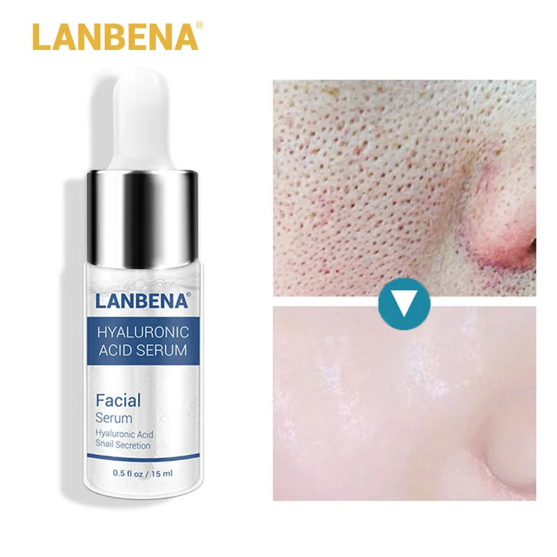 

Six Peptide Hyaluronic Acid Face Serum Acne Treatment Anti-Aging Anti-Winkle Whitening Moisturizing Shrink Pores Essence