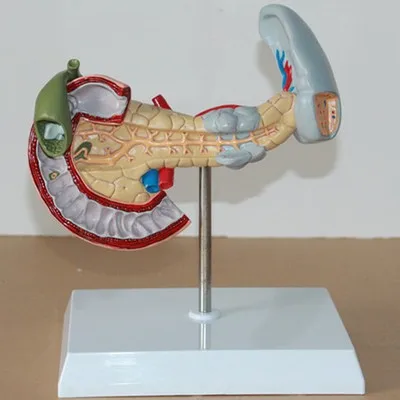 Модель патологических изменений панкреи и селезенки двойной желчный пузырь