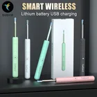 Оригинальные умные визуальные ушные палочки Bebird R3 R1, 300 Вт, высокоточное удаление ушного воска, очистка ушей, отоскоп для камеры, уход за ушами, очиститель ушей