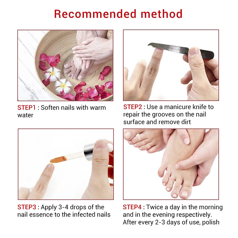 

Nail Fungal Treatment Feet Care Essence Nail Foot Whitening Toe Nail Fungus Removal Gel Anti Infection Paronychia Onychomycosis