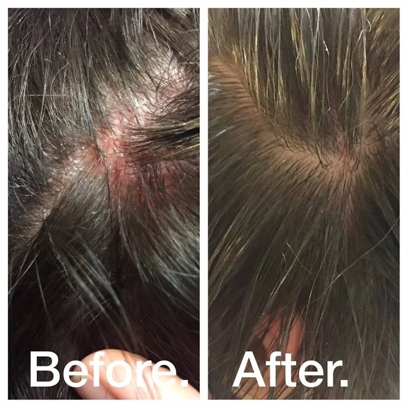 

Sea Salt Anti-Dandruff Shampoo Cream Relieve Itching Control Oil Hair Shampoos Hair Care