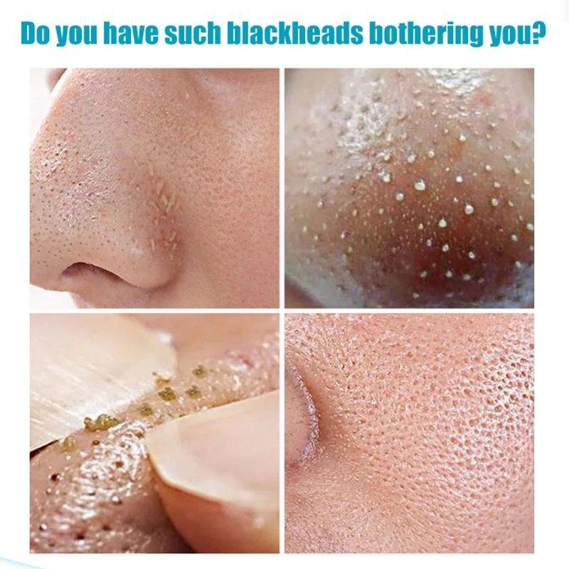 40 г Зелёный чай для удаления черных точек маска удалите угри на носу глубокого