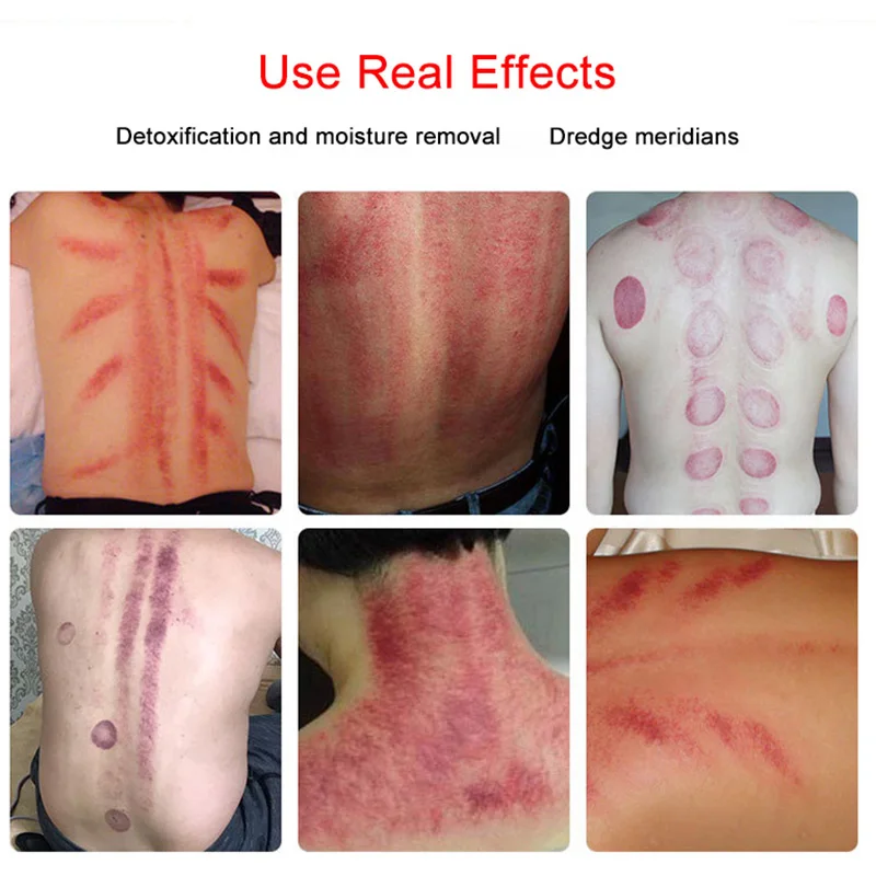 Терапия меридиан для массажа микротоковая Электротерапия похудения облегчение