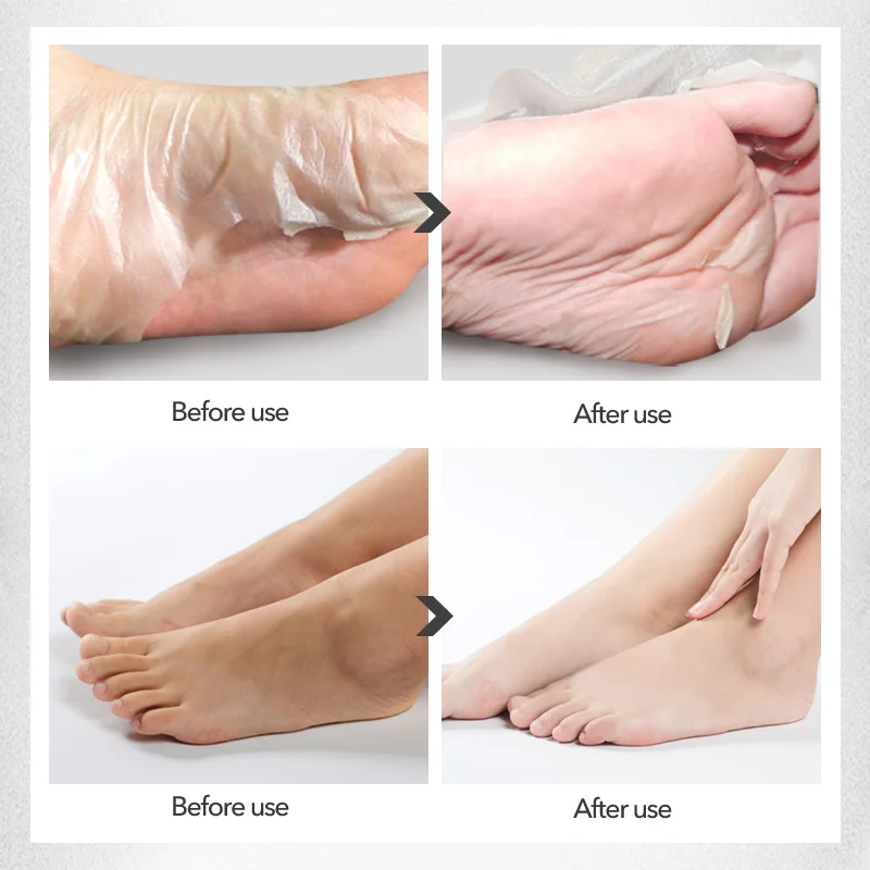 Отшелушивающие носки 5 шт. = 10 пилинг с улиткой маска для ног отшелушивающие носок