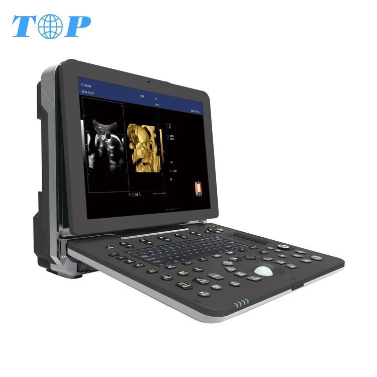 

TOP-A1020 portable color doppler ultrasound scanner machine price