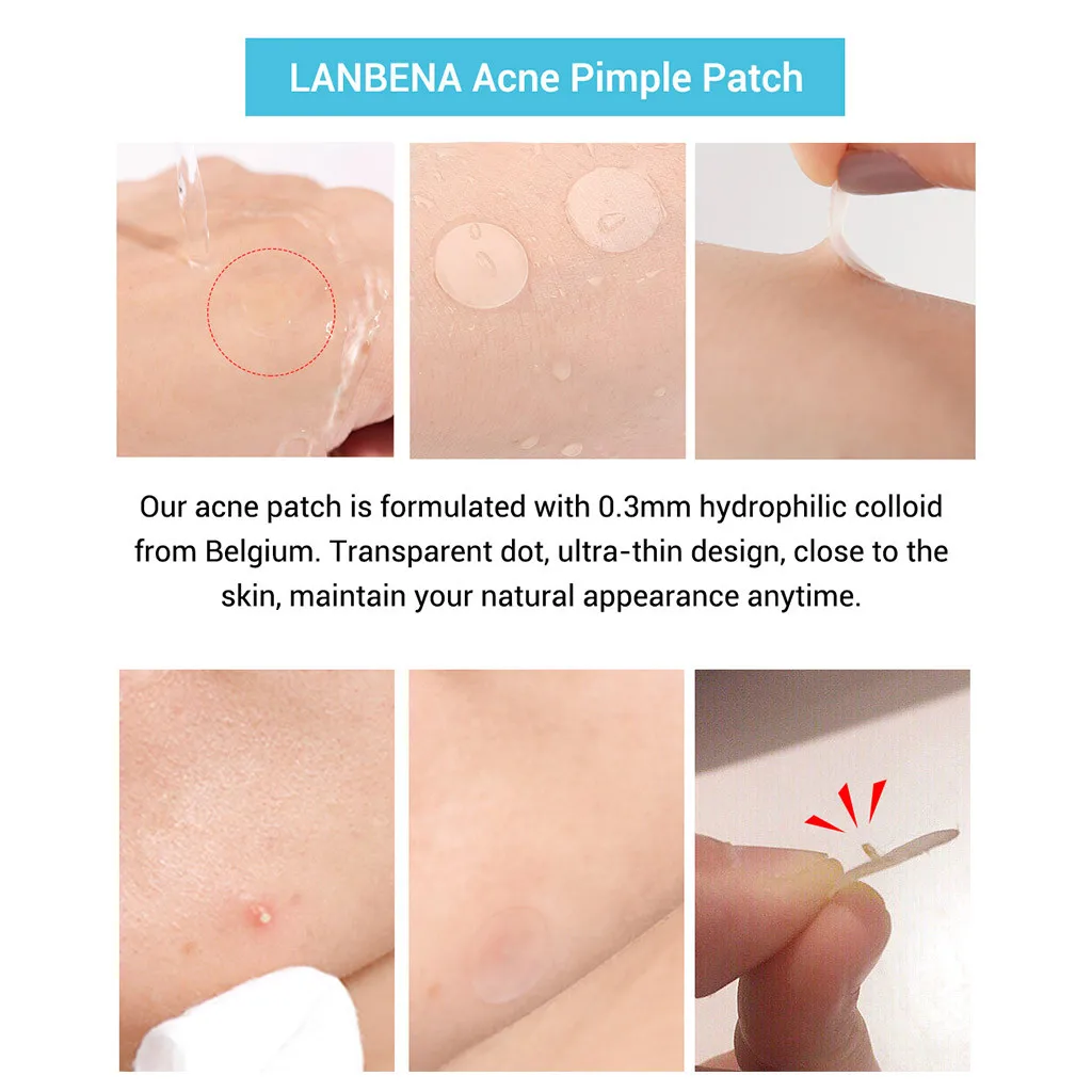 Patch Acne Pimple Master Invisible Stickers Skin Face Spot Scar Care facial skin care blackhead removal Freckle acne mask #1223