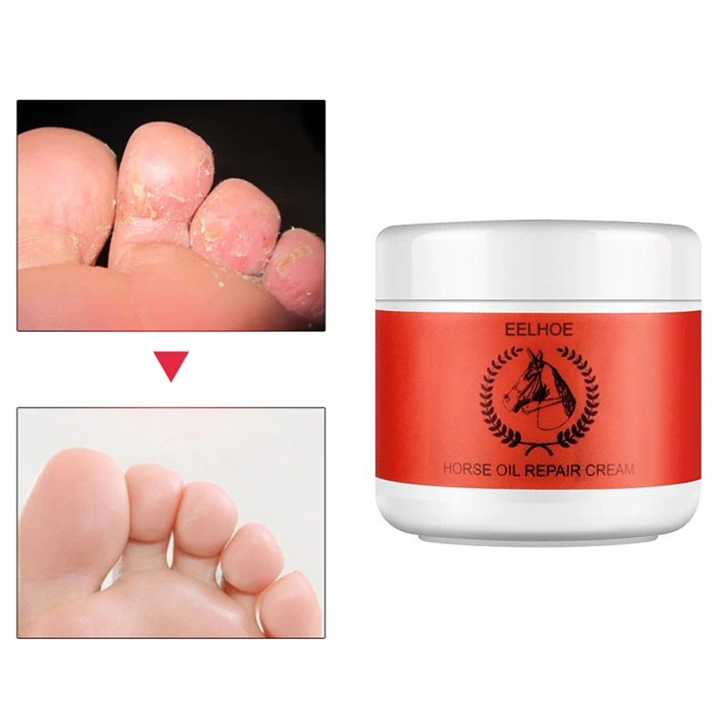 На основе конского жира крем для пяток ремонта против трещин отбеливающий ног