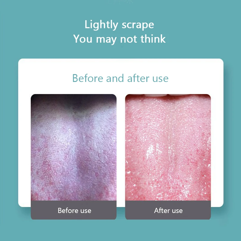 

Stainless Steel Tongue Scraper Brush Cleaning Surface Of Tongue Oral Medical Mouth Reusable Brush Keep Fresh Breath Healty Care