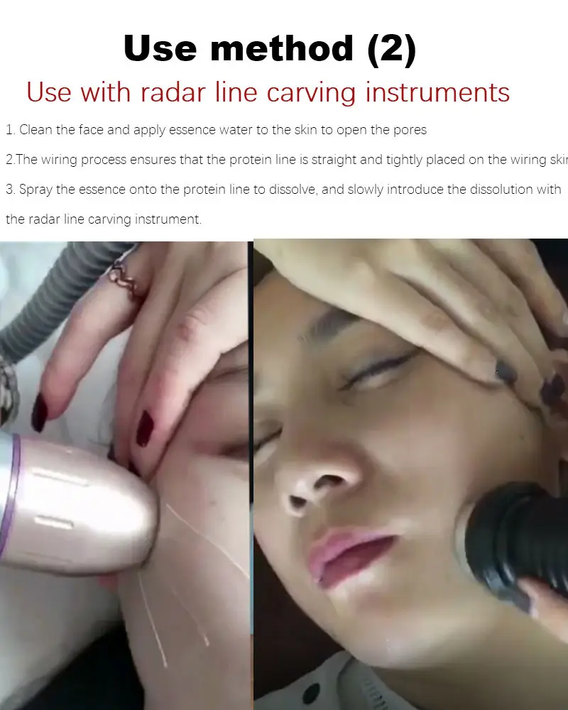 Рисунок 6 - 400 мешков, радар-нить