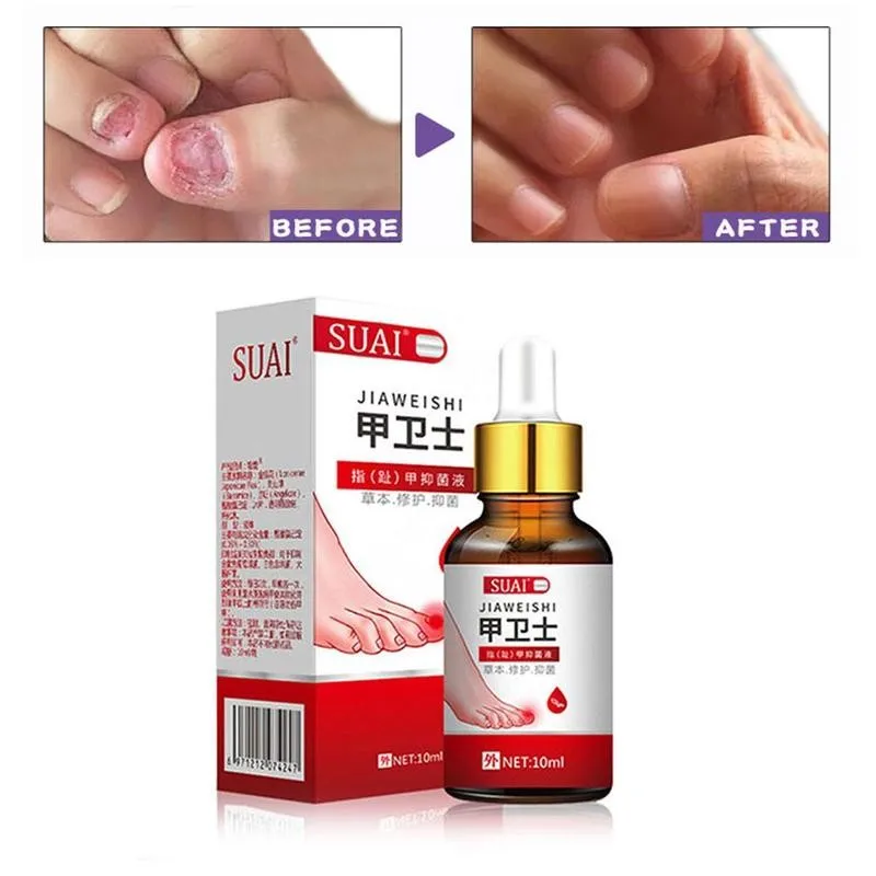 Nail Fungal Treatment Feet Care Essence Nail Foot Whitening Removal Anti Toe Gel Paronychia Fungus Infection Nail Onychomyc B8C4