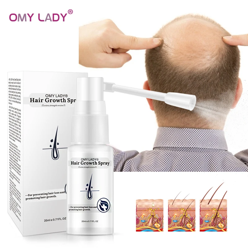 

Effective Ginger Hair Growth Spray Serum Anti Hair Loss Essential Oil Germinal Repair Growing Treatment Hair Loss Products