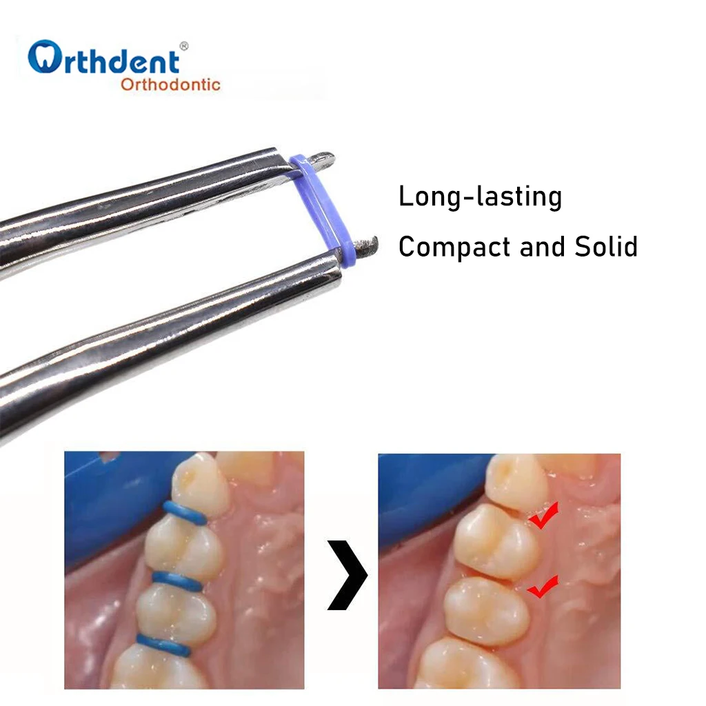 Ортодонт 1000 шт Ортодонтические сепараторы стоматологические раздельные резинки