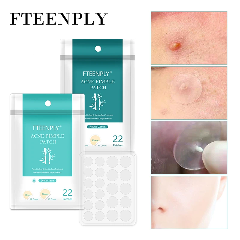 FTEENPLY Acne Pimple Patch Invisible Acne Treatment Stickers Face Mask Blemish Comedo Remover Facial Beauty Skin Care Tool 22PCS