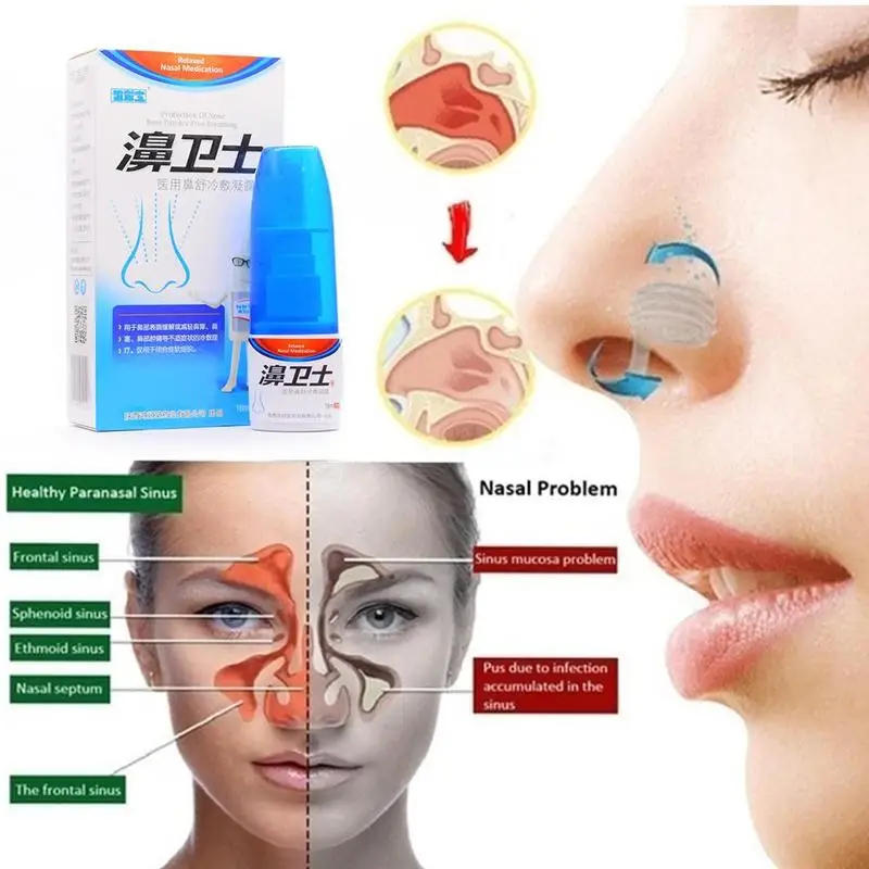 

1Pcs Nasal Sprays Chronic Rhinitis Sinusitis Spray Rhinitis Herb Spray Treatment Traditional Nose Medical Care Chinese D0H7