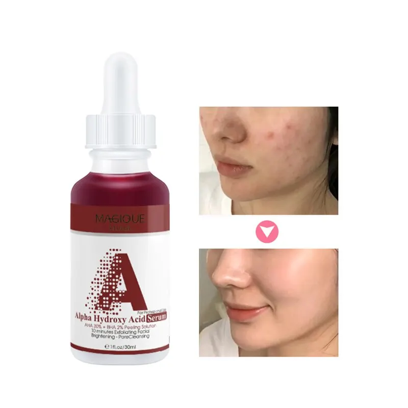 

Face Serum 10-Minute Exfoliating Face AHA 30%+ BHA 2% Peeling Solution 30ml Blemishes Remove Acne Scars Whitening