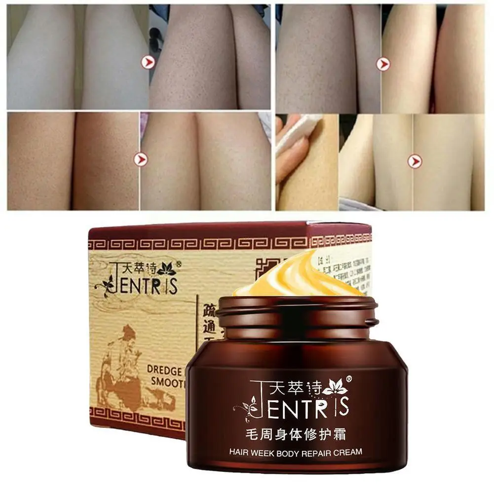 

50g Cream for Keratosis Pilaris/ Kp/ Chicken Skin Body Lotion Skin Repair Cream Skin Care Essence Moisturizing And Nourishi X6H5