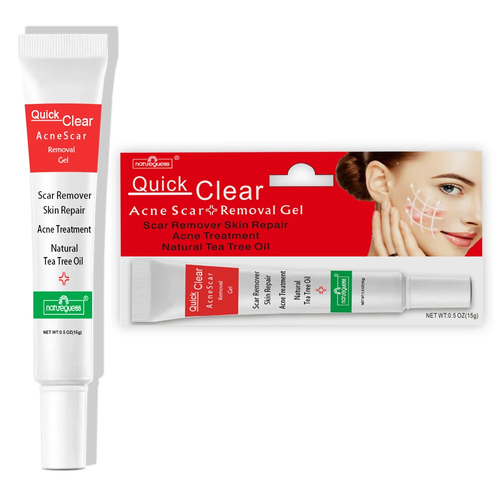 Эффективный крем для удаления акне 10 шт./лот лечение прыщей контроль жирности