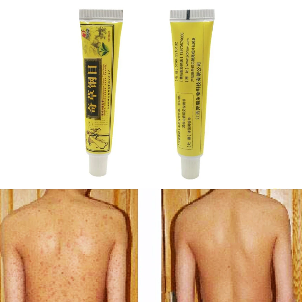 Китайская травяная кожа актуальная антипретическая мазь крем анальгетический
