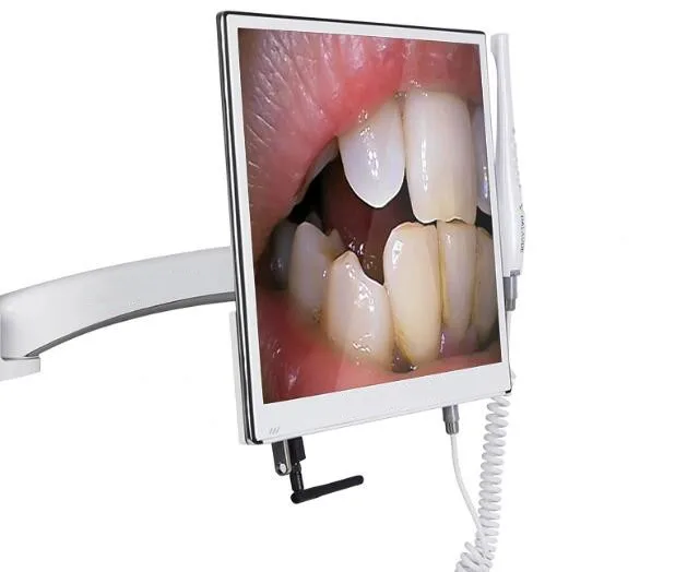 Стоматологическая Wi Fi эндоскопическая камера + Ультратонкий 8 миллионов пикселей