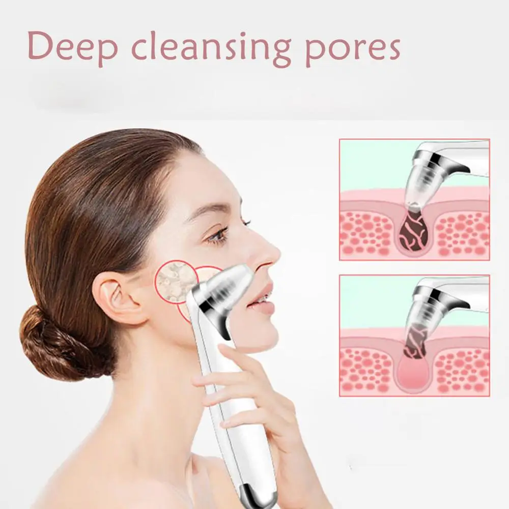 

Pore Cleaner Blackhead Remover Face Pore Vacuum Skin Care Deep Cleansing Machine Pimple Removal Women Beauty Tool