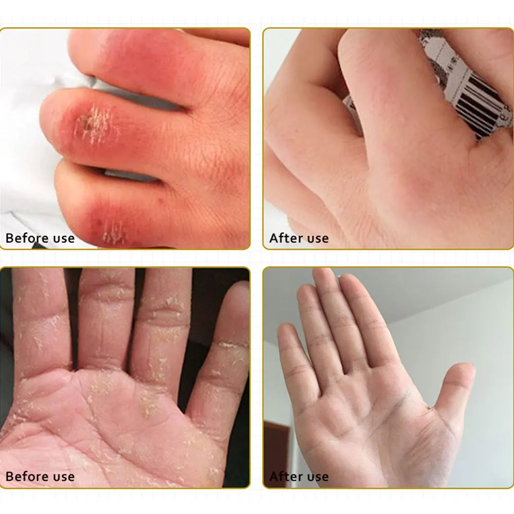 Крем для рук ARTISCARE Horse Oil и крем ног 2 шт. антивозрастной зимний питательный