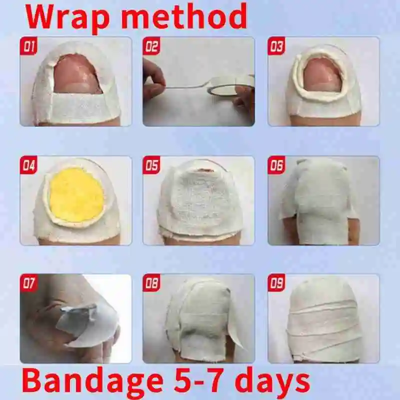 Китайская медицина травы брикет Лечение грибка удаление ногтей