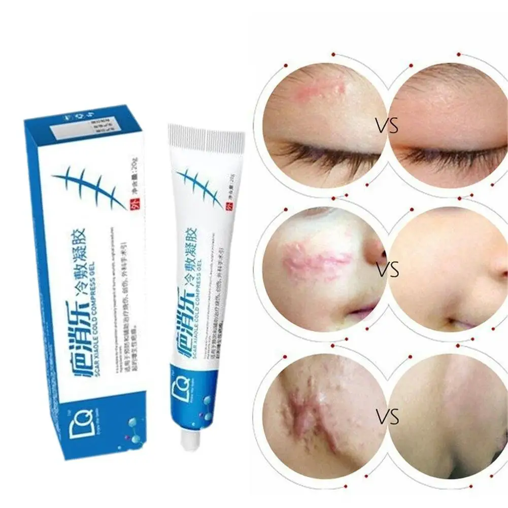 

20g Effective Acne Scar Removal Cream Pimples Stretch Marks Face Gel Remove Acne Smoothing Whitening Moisturizing Skin Care