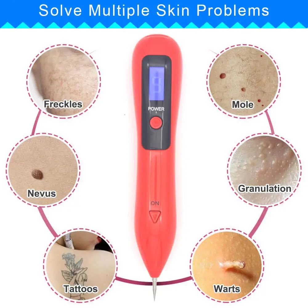 Моль Nevus ручка для удаления бородавок устройство для удаления плазмы электрический лазерный инструмент кожа лица Кукуруза веснушки тег Темный возраст развертки пятна татуировки