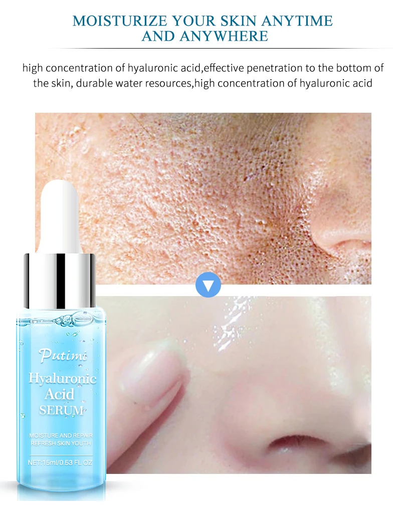 EFERO 1 Bottle Anti Acne Face Serum Skin Care Essence Moisture Whitening Cream Anti Aging Serum Acne Remover Shrink Pores