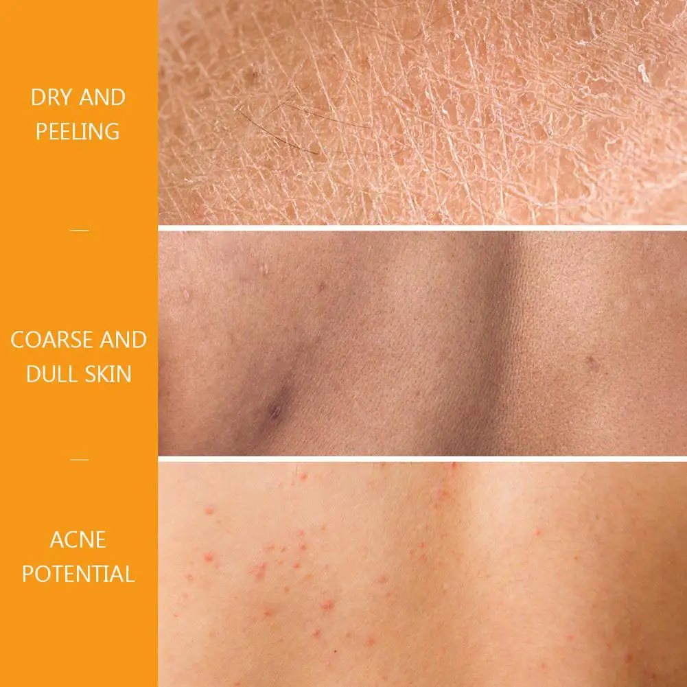 

Blue ZOO 200ml Repair Shower Gel Nourishing Whitening removes dirt and oil reduce acne deep cleansing body skin care