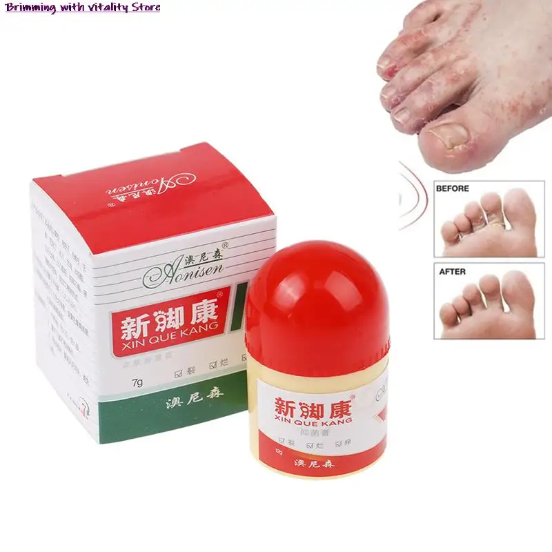 

Foot Cream Antibacterial Foot Cream Foot Rot Peeling Itching Blisters To Remove