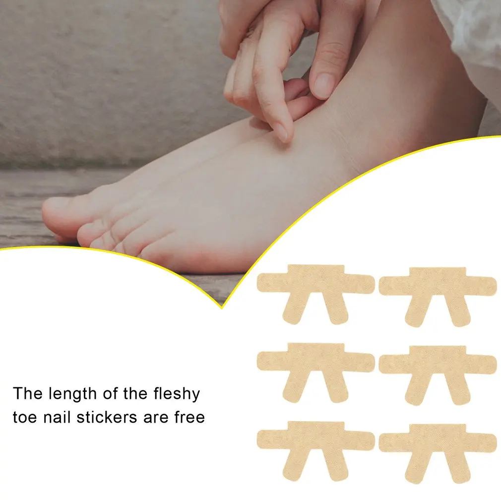 

Nail Cotton Toenail Nail Groove Inlay Toe Nail Correction Nail Patch Quick To Correct Toe Nail Deformation