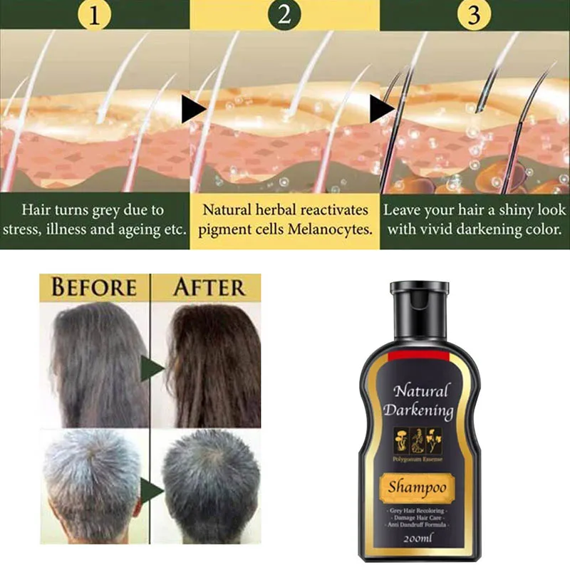 Шампунь для серых волос EY669 мужчин и женщин твердый против перхоти|Шампуни| |