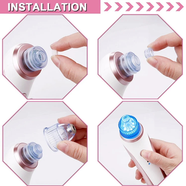 Пылесос Электрический с Usb-зарядкой для удаления черных точек на лице | Красота и