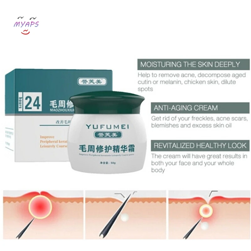 

50g Curing Keratosis Pilaris/ Kp/ Chicken Skin Body Lotion Skin Repair Cream Skin Care Essence Moisturizing And Nourishing