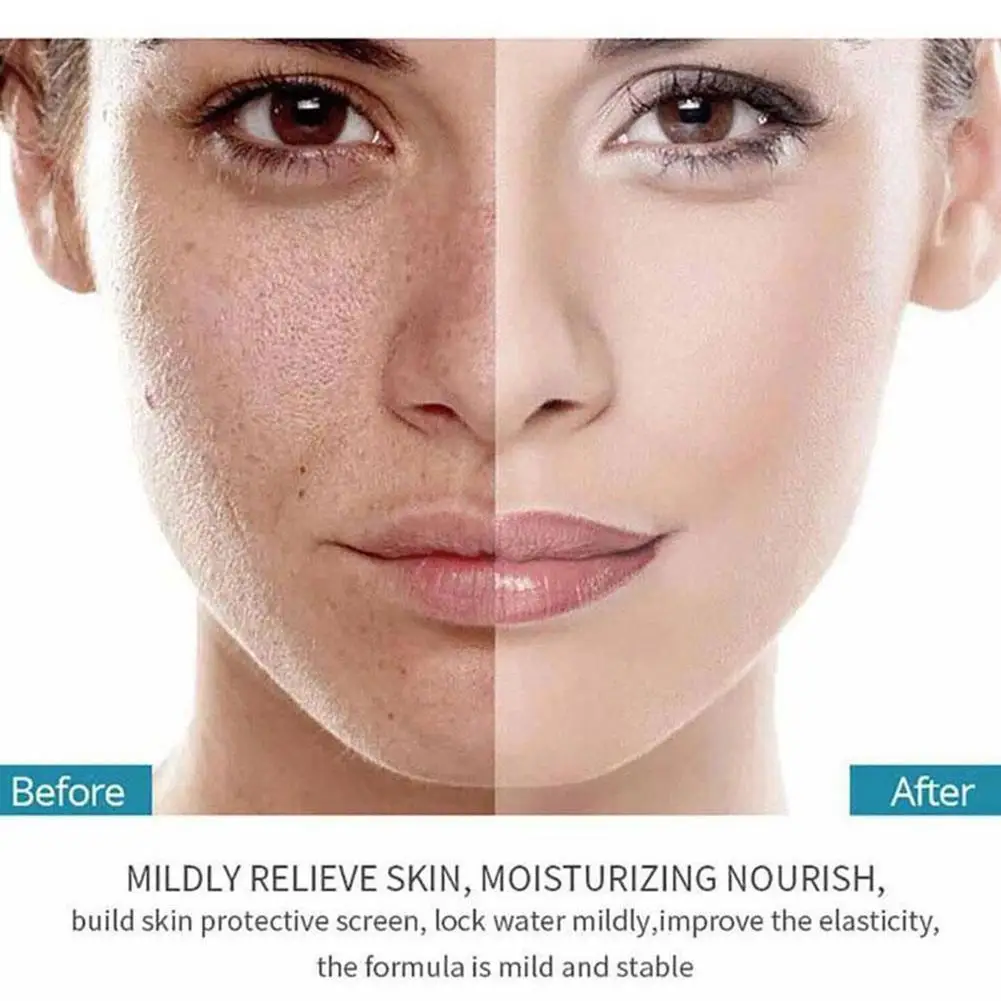 

Skin Rejuvenation Salicylic Acid Hyaluronic Acid Repair Brighten Lighten Freckles, Skin Eliminate Melanin Tone, And Acne, X1X0