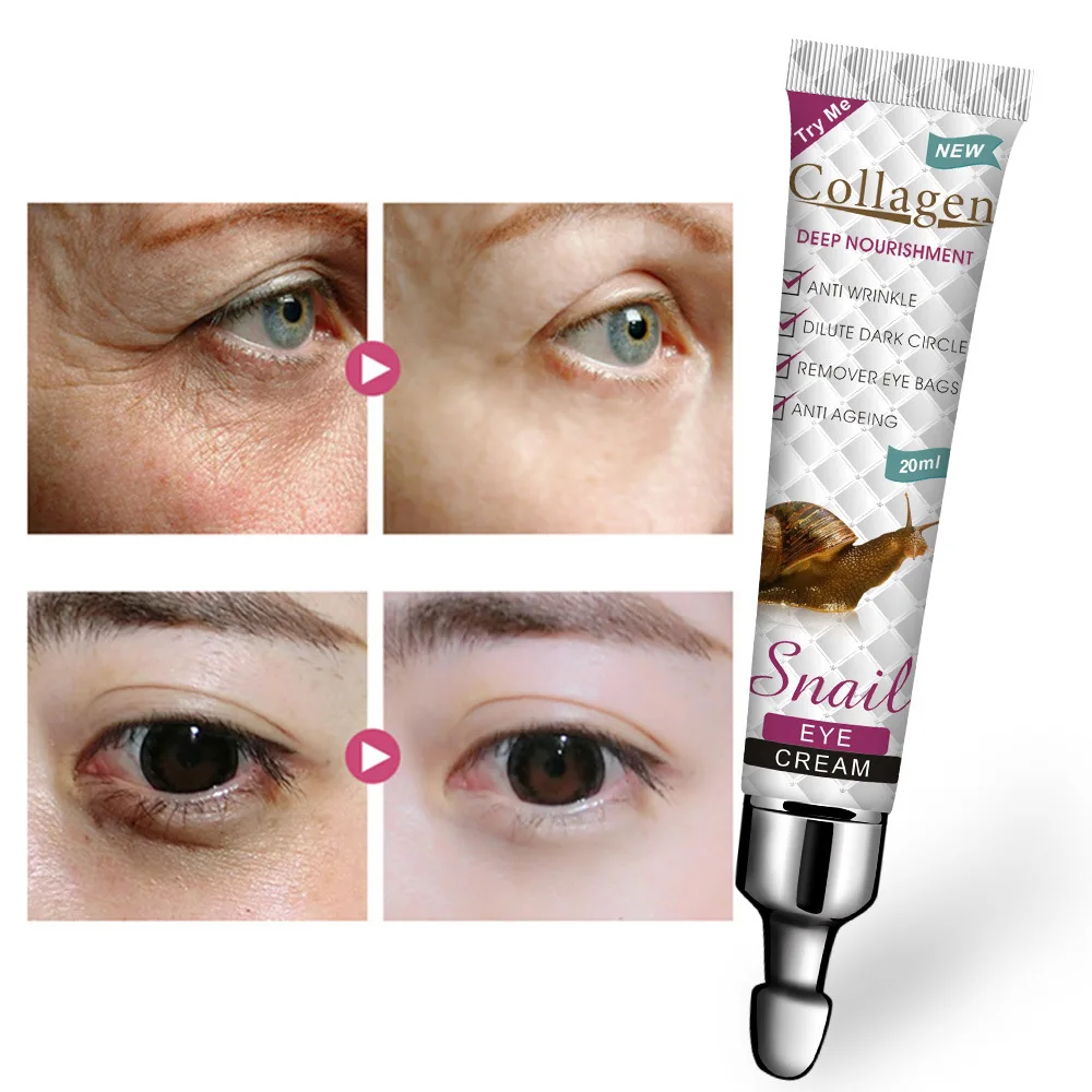20ml Snail Firming Eye Cream for Dark Circles &amp wrinkles Fat Granule Anti-aging Anti-Puffiness Moisturizer Skin Care |