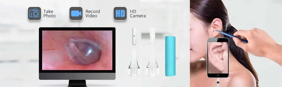 

USB Ear Cleaning Scope Endoscope 3 in 1 Mini Earpick Wax Camera 5.5mm Medical Otoscope HD Otoscopio Digital for Android Phone