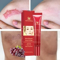 acne scar removal face cream acne spots acne pigmentation corrector whitening gel anti scar stretch marks repair skin care 15g
