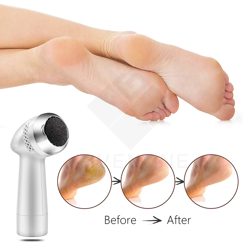 Электрические пилки для ног вакуумный аппарат педикюра устройство удаления