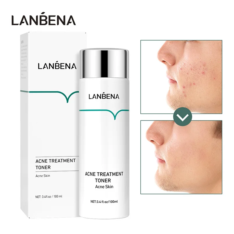 

LANBENA Acne Treatment Toner Oligopeptide Anti Acne Prelude Deep Moisturizing Plant Extracts Soothes Repair Skin 100ml