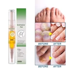 Новинка 2021, восстанавливающий крем для ногтей, не восстанавливающий гель для ногтей, оптовая продажа, Прямая поставка