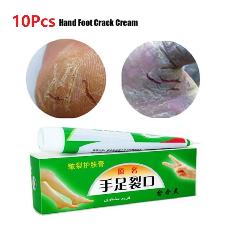 10 шт./лот мощный крем для восстановления растрескивания кожи мазь пятки