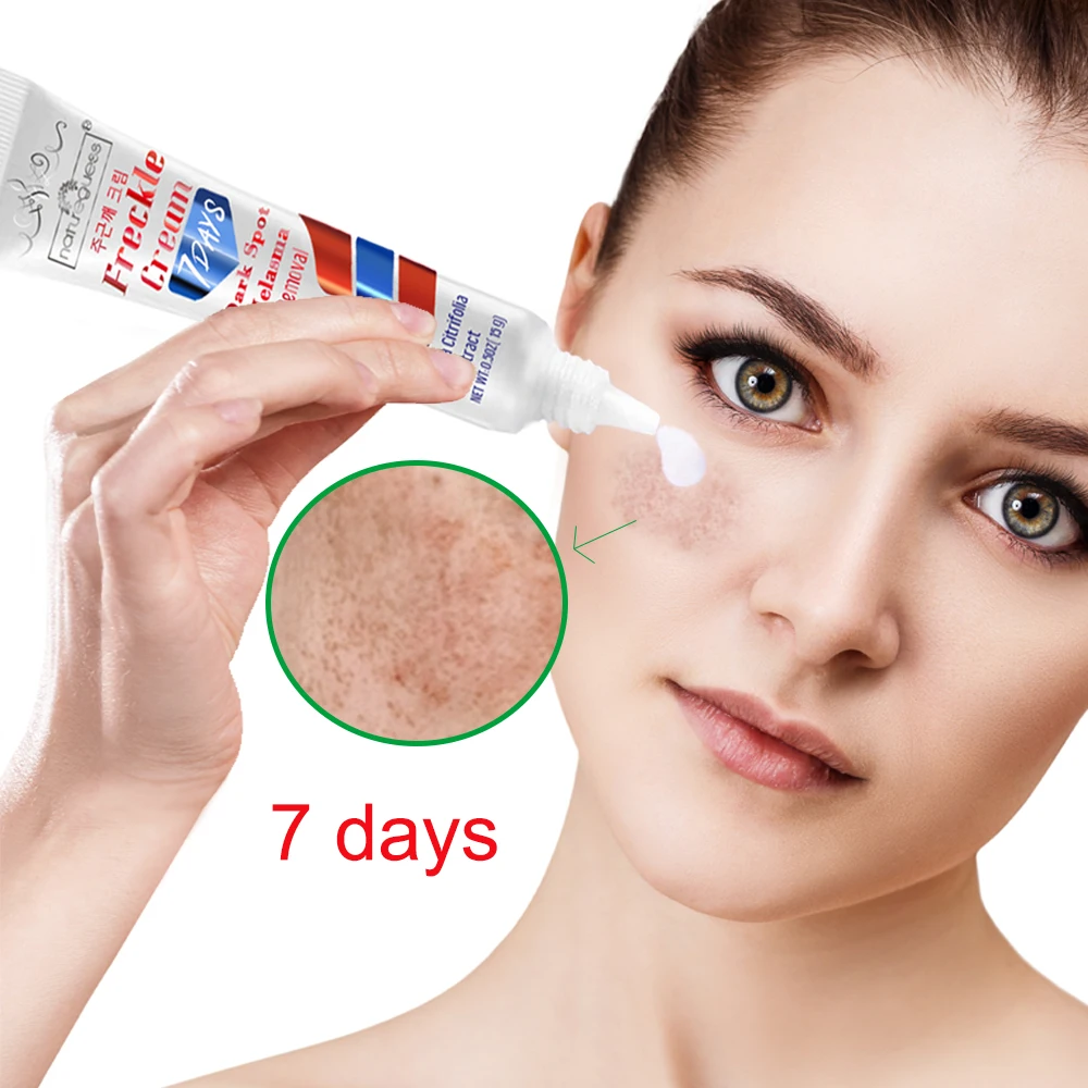Мгновенное лечение крем для отбеливания веснушек лица мелазма удаления темных