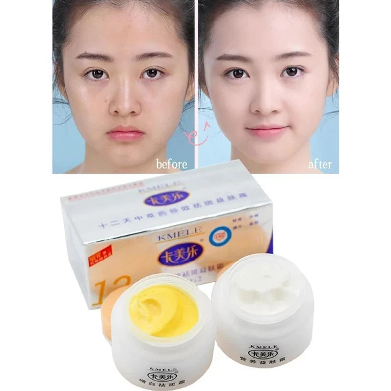 

Отбеливающий крем Kmele, 2 бутылки, женское средство для удаления кожи, крем для выцветания, веснушки