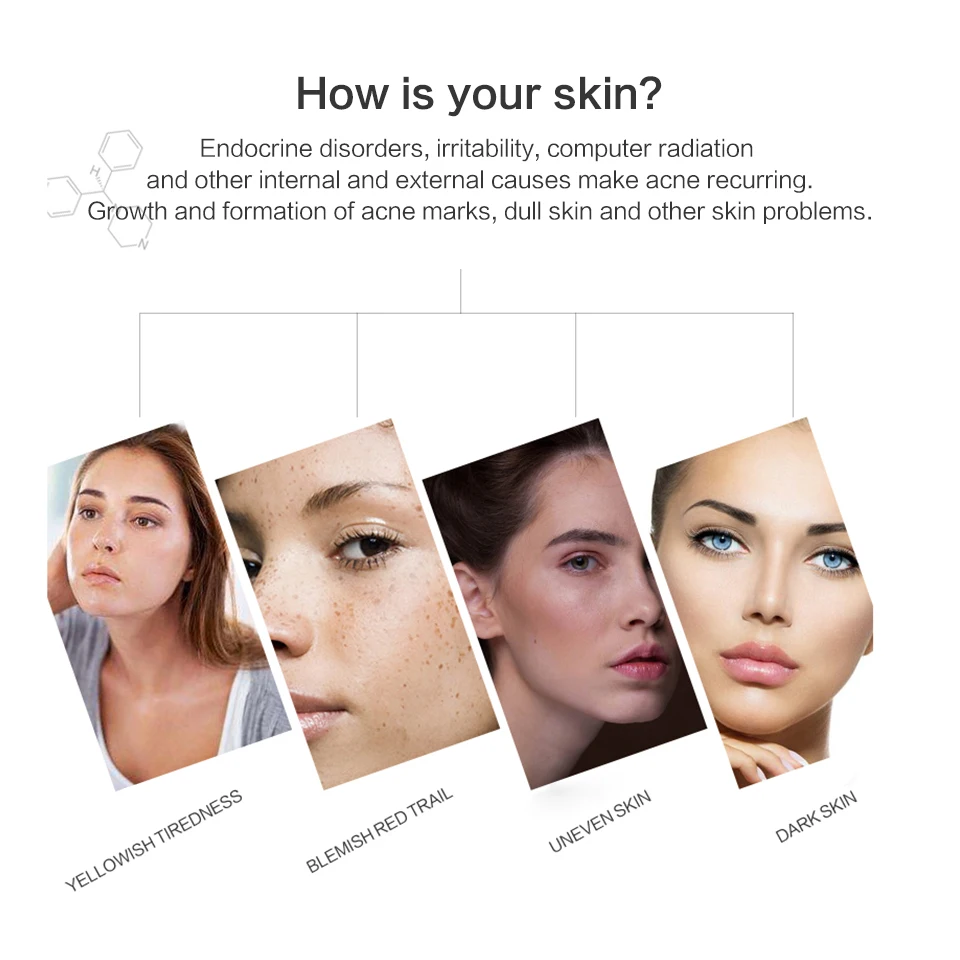 Оригинальный Sesderma Acne средство для уменьшения шрамов Сыворотка 15 мл ACNISES Spot color Cream