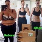 Пластырь для похудения китайская медицина, 100 шт., клейкие подушечки для снижения веса и похудения, Антицеллюлитный инструмент для подтяжки лица