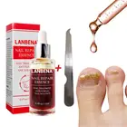 LANBENA, сыворотка для восстановления ногтей, лечение, удаление грибка ногтей на ногах, гель против паронихии онихомикоза горячая распродажа