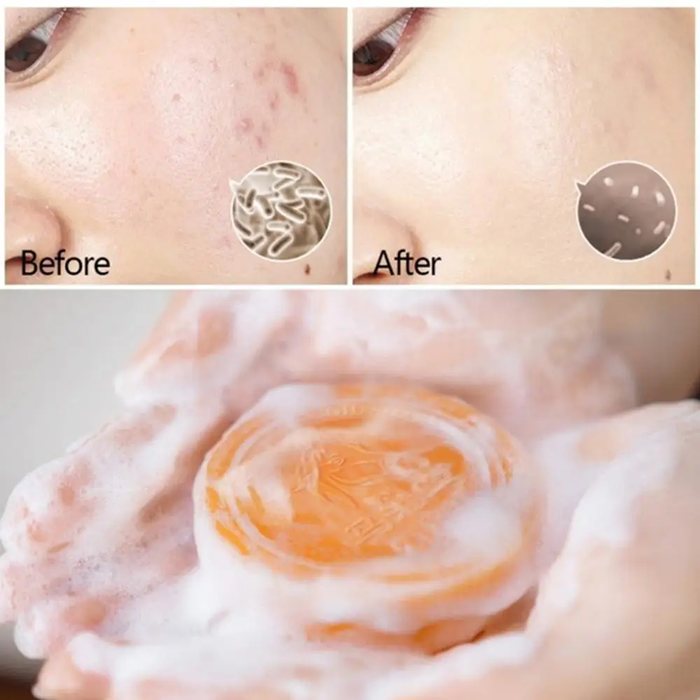 80 г конского масла мыло ручной работы для угрей уход чистый натуральный Тип