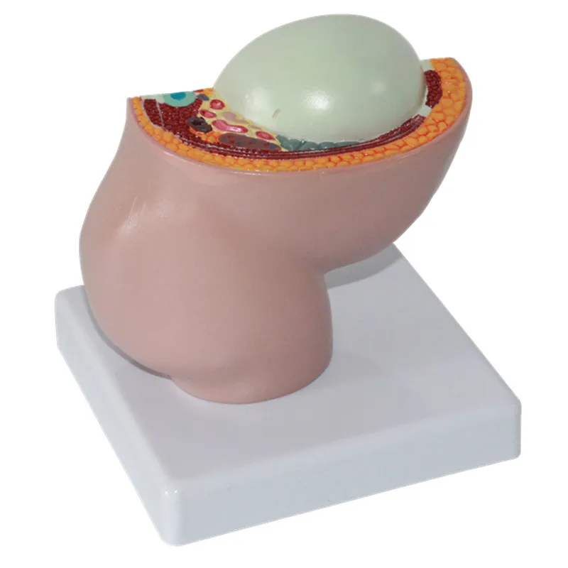 Отсоединяемая женская модель эмбриона для таза 9 месяцев беременности плода